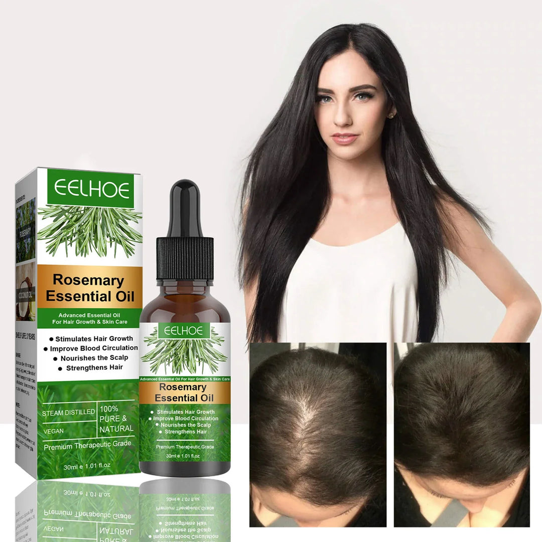 Rosemary Essential Oil Hair Growth Oil – Pure Natural 30ml