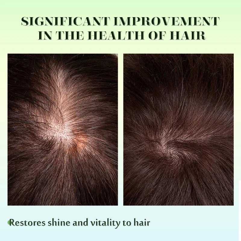Rosemary Hair Growth Oil