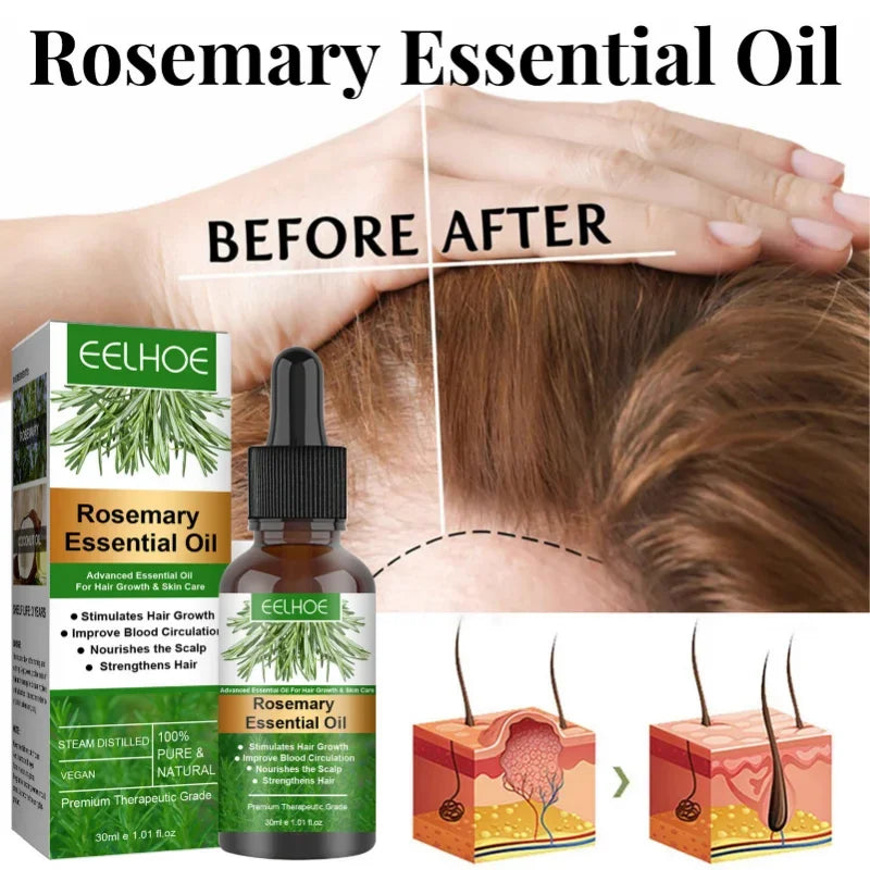 Rosemary Essential Oil Hair Growth Oil – Pure Natural 30ml