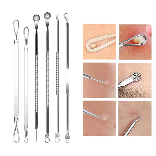 Blackhead Removal Tool Kit – Acne & Pore Cleansing Set (4–11 Pcs)