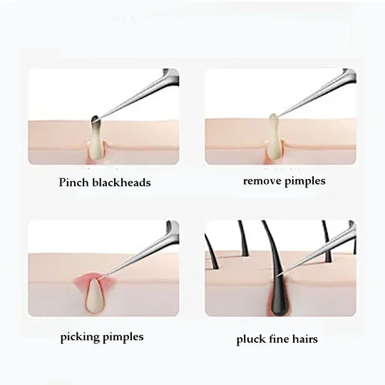 Blackhead Removal Tool Kit – Acne & Pore Cleansing Set (4–11 Pcs)