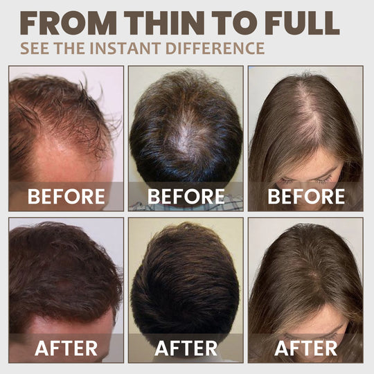 Hair Fibre Powder 30g – Instant Volume & Thickness for Thinning Hair
