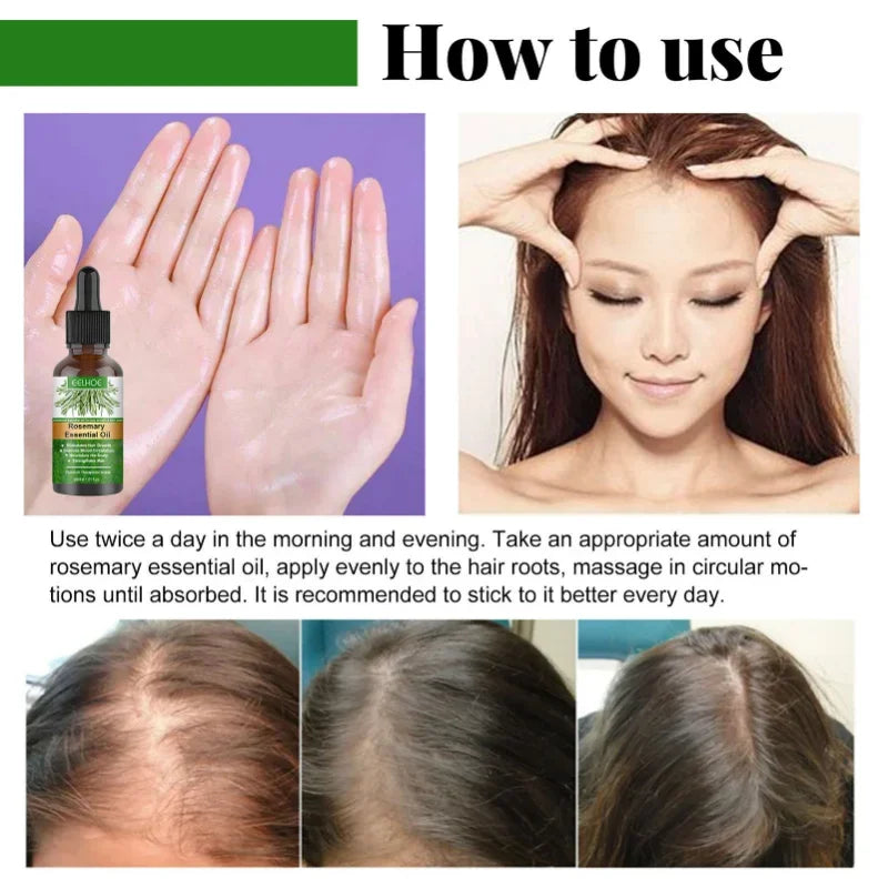 Rosemary Essential Oil Hair Growth Oil – Pure Natural 30ml