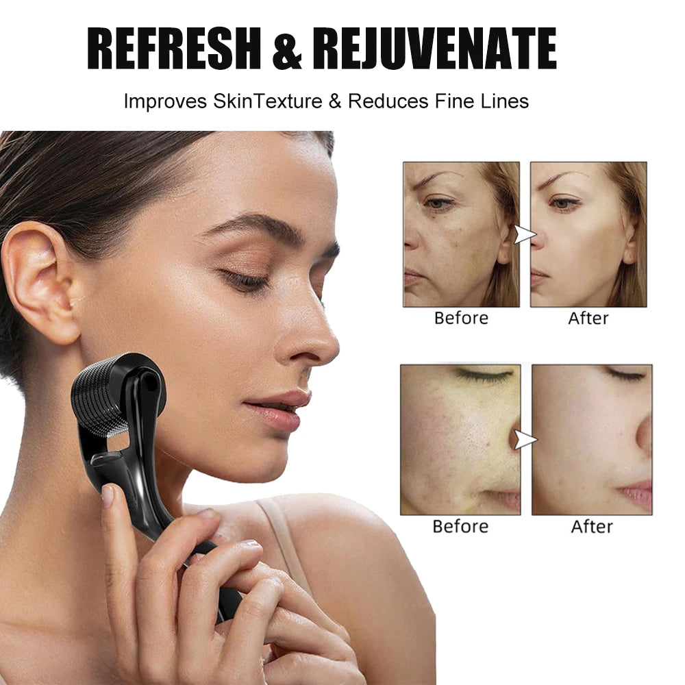 Derma Roller for Hair Growth (0.5mm)