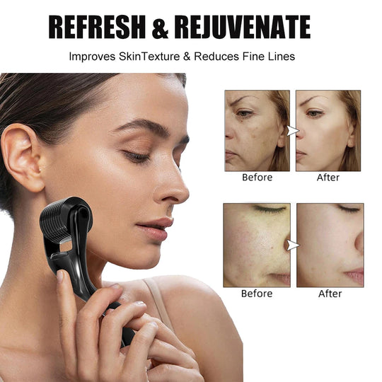 Derma Roller for Hair Growth (0.5mm)