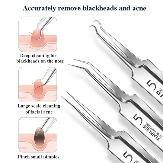 Blackhead Removal Tool Kit – Acne & Pore Cleansing Set (4–11 Pcs)